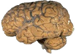 Human brain - planned obsolescence